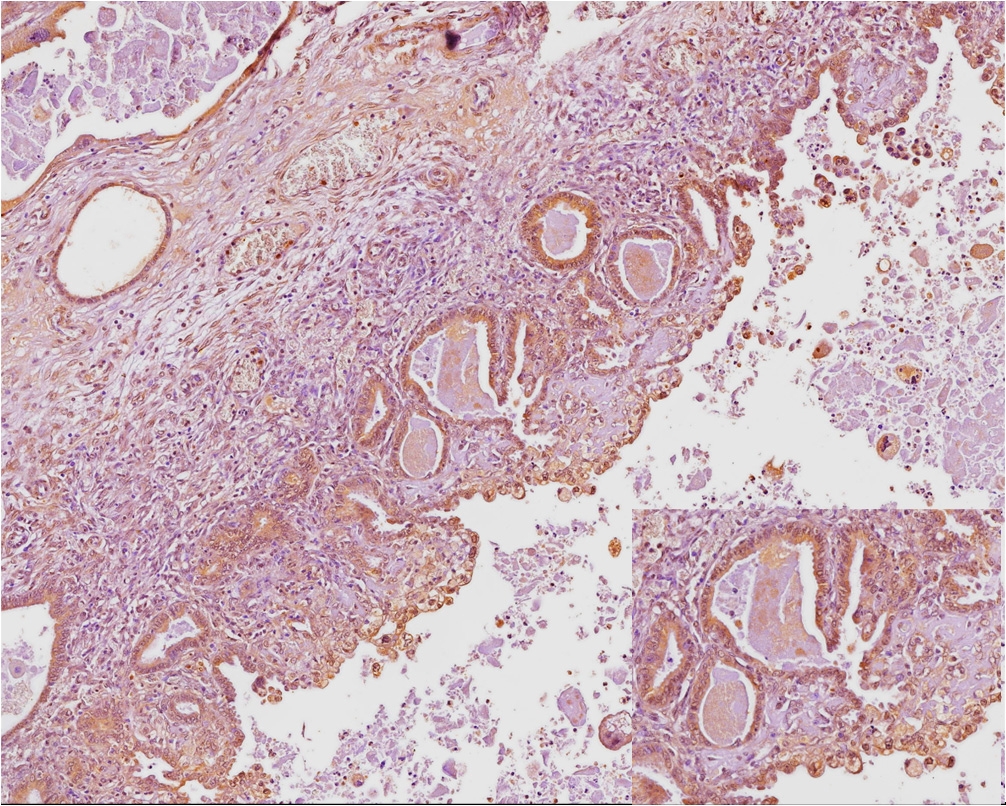 Figure 4c - Intense Staining