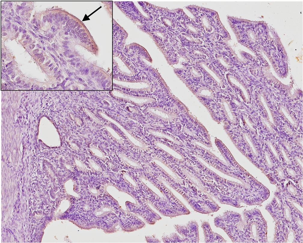 Figure 5b - Hyperplasia COX-2