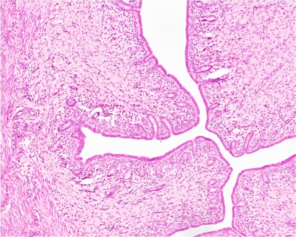 Figure 3a - Normal Endometrium